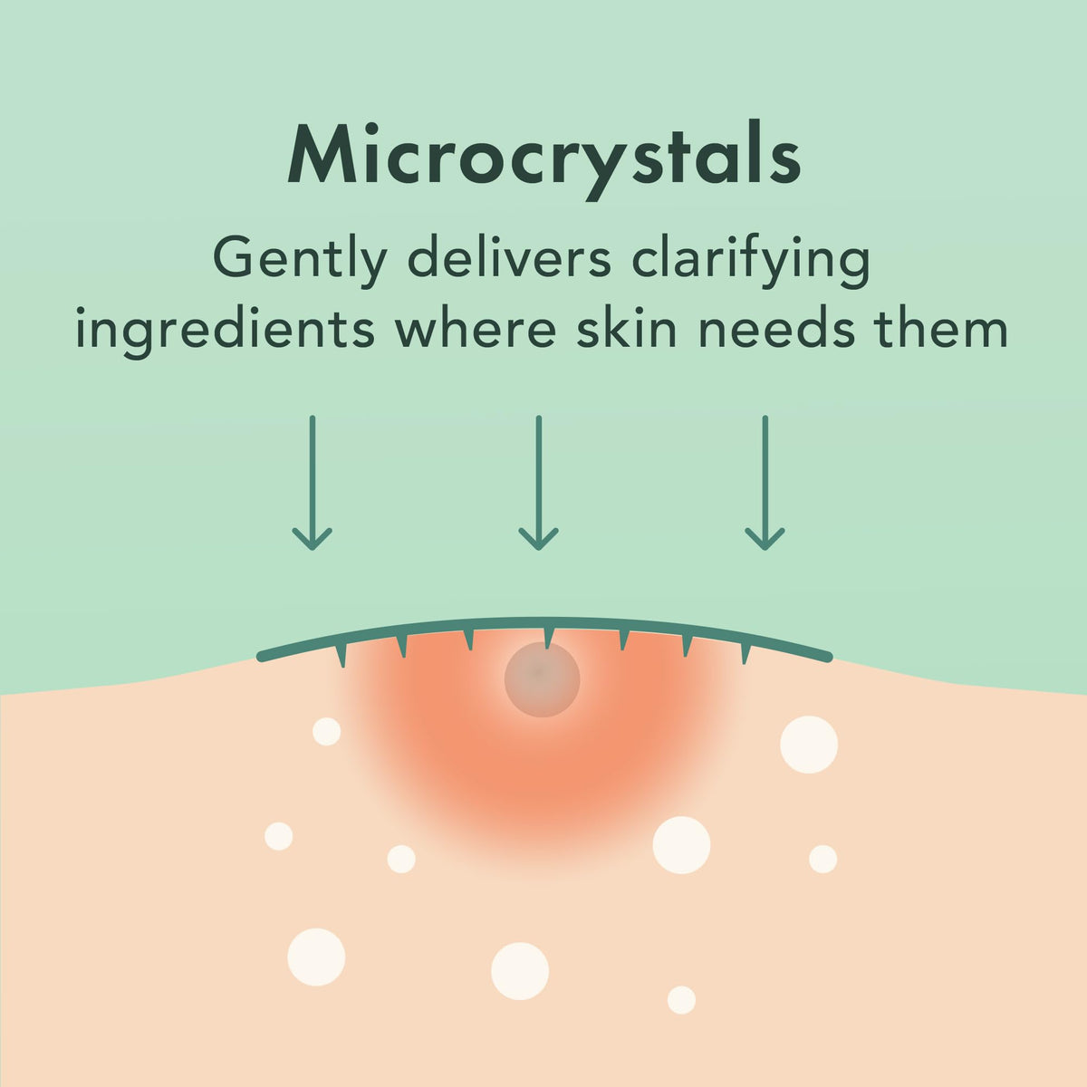 Rael Hydrocolloid Pimple Patch applied on skin