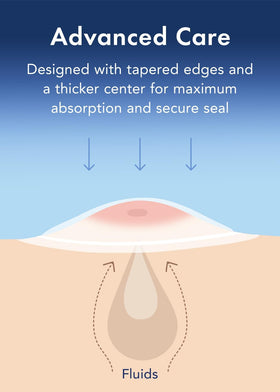 Rael Miracle Retinol PM Spot Cover Hydrocolloid Acne Patches in use