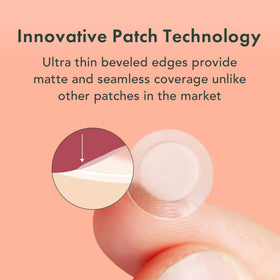 Rael patches showing two sizes 10mm and 12mm