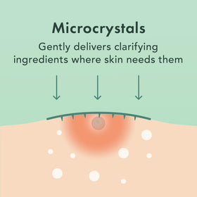 Rael pimple patches displayed on a flat surface