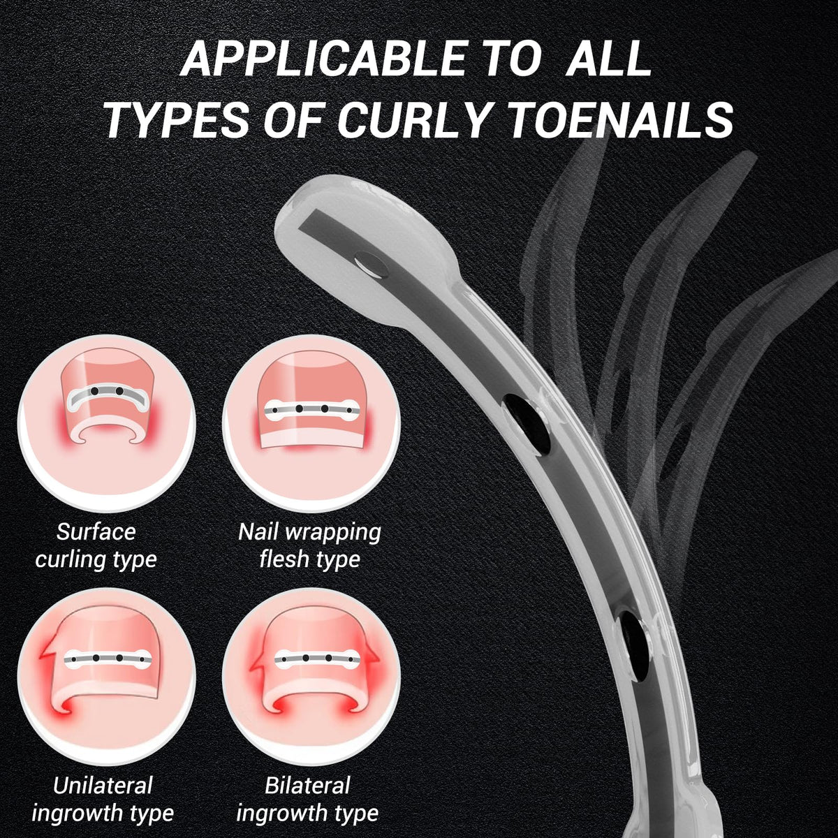 Reieset Ingrown Toenail Kit contents laid out
