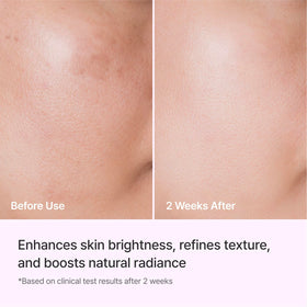 REJURAN Triple Radiance Ampoule side view