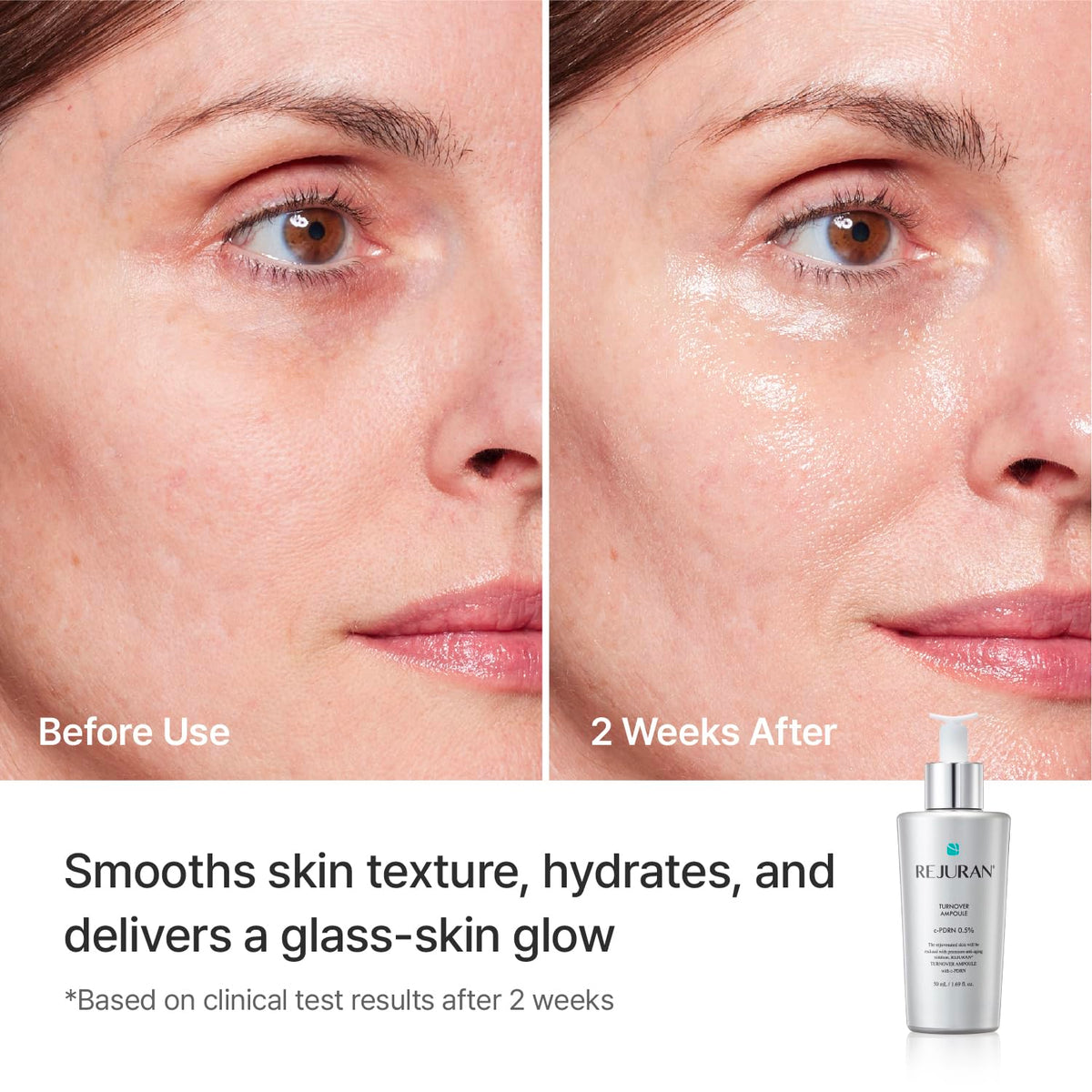 REJURAN Turnover Ampoule ingredients list on packaging