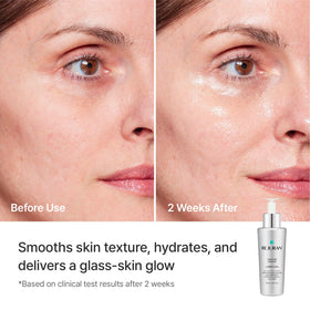 REJURAN Turnover Ampoule with ingredients displayed