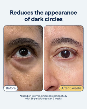 Remedy Science Dark Circles Eye Cream texture close-up