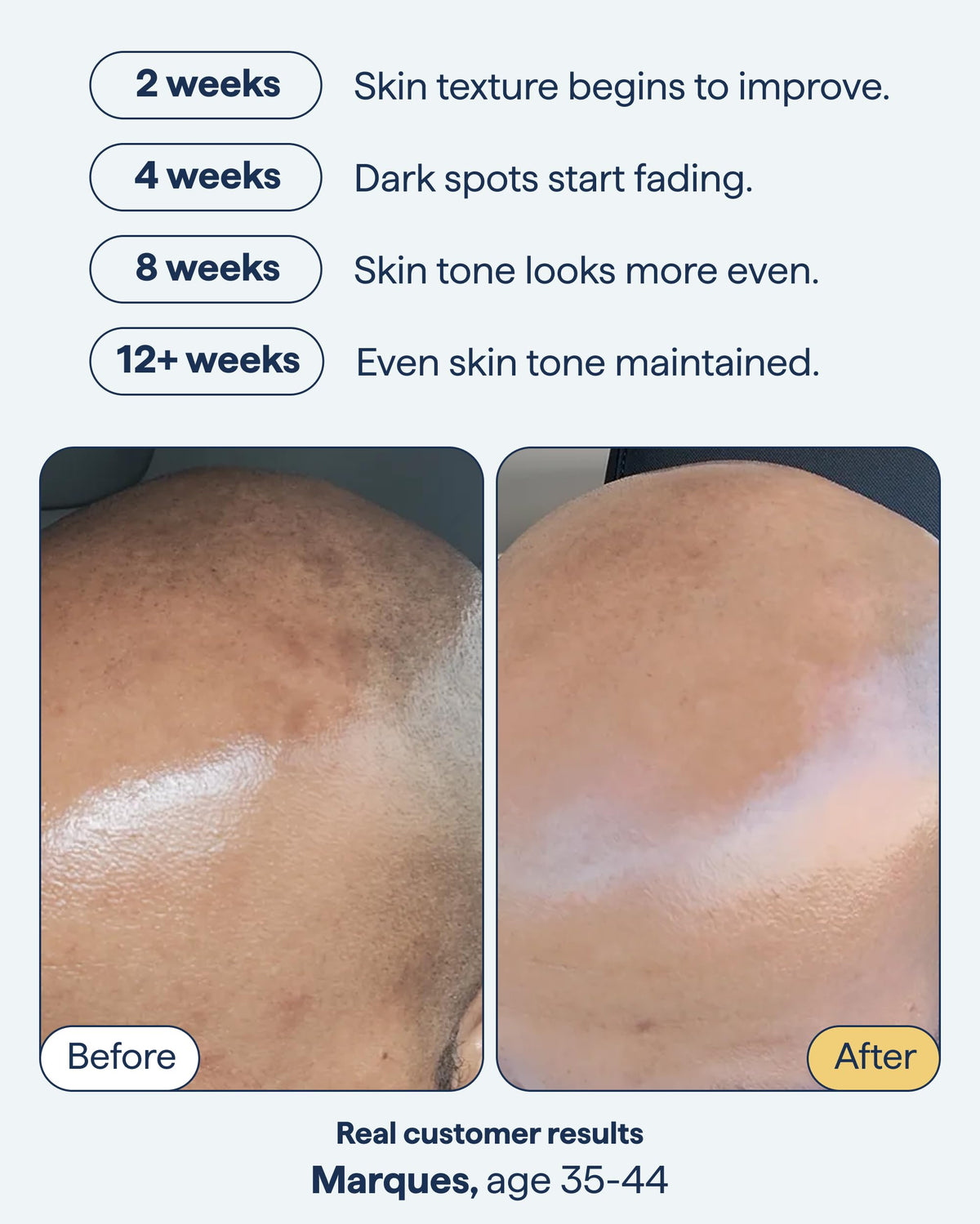 Remedy Science Dark Spot Correcting Serum 118g side view