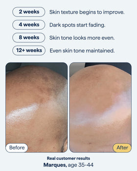 Remedy Science Dark Spot Correcting Serum 118g side view