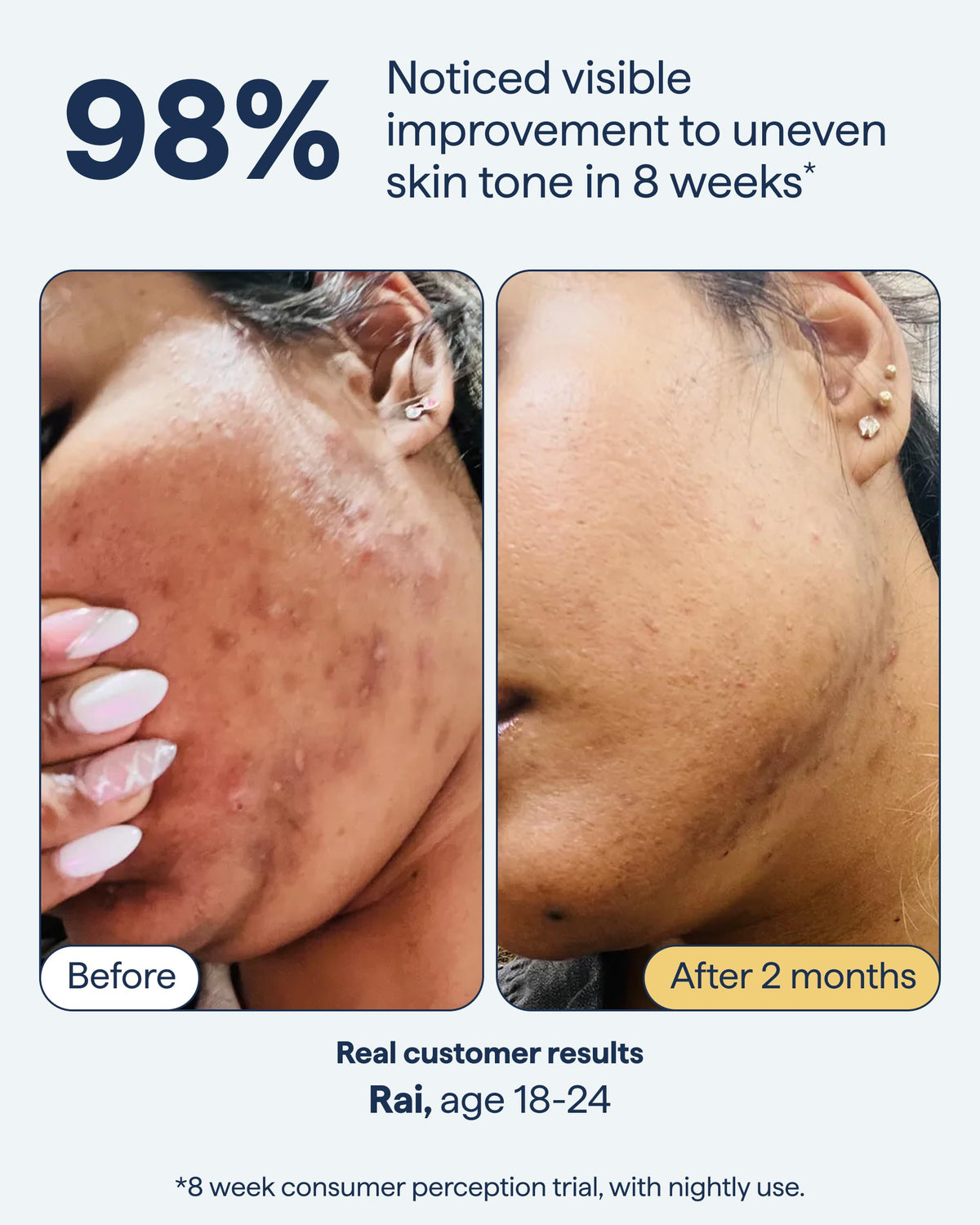 Remedy Science Dark Spot Correcting Serum lifestyle scene