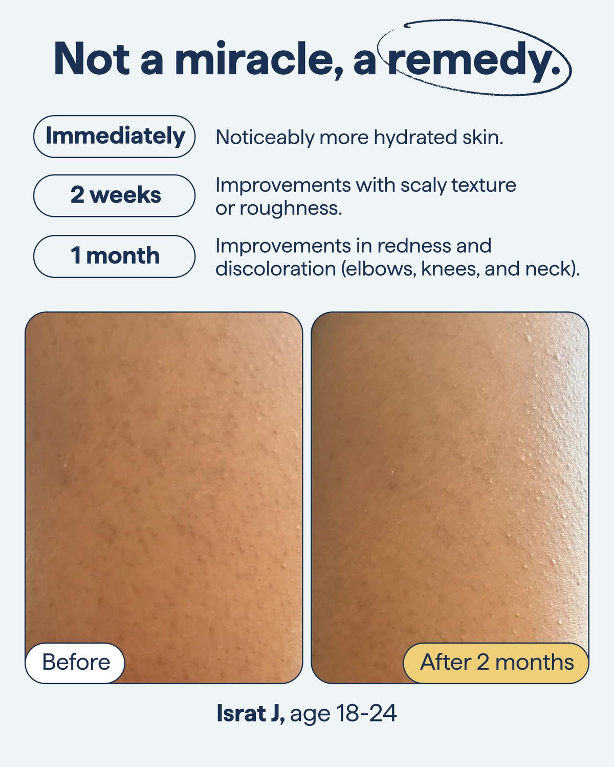Remedy Science KP Body Moisturizer 259g packaging details