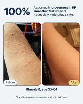 Remedy Science KP Body Moisturizer 259g texture close-up