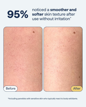 Remedy Science KP Exfoliating Body Scrub packaging side view