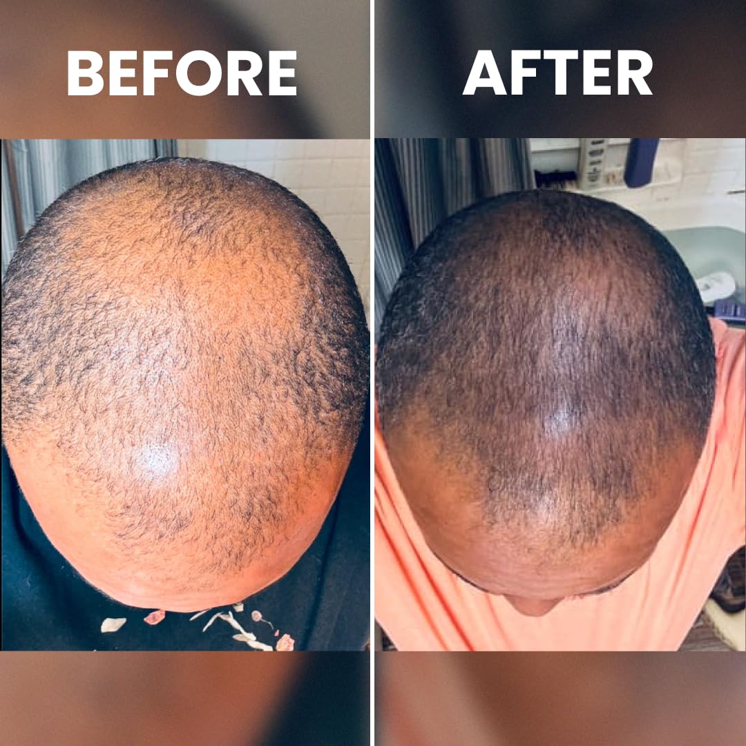 RENNORA BEAUTY Hair Growth Serum close-up of bottle
