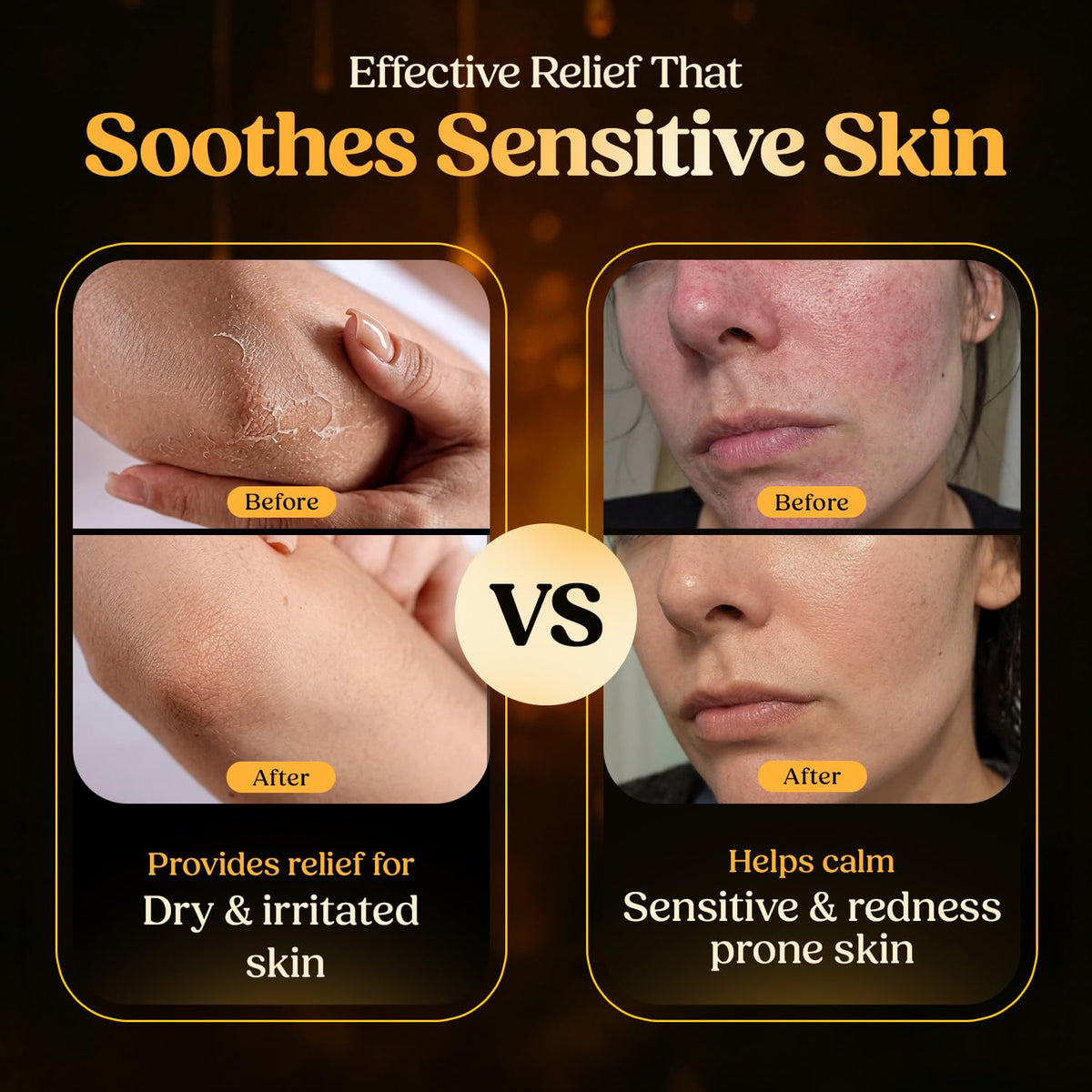 Reroot Organics Manuka Honey Beef Tallow Balm in a lifestyle setting
