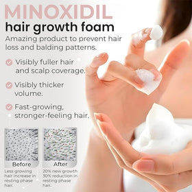 Rida Minoxidil foam packaging details