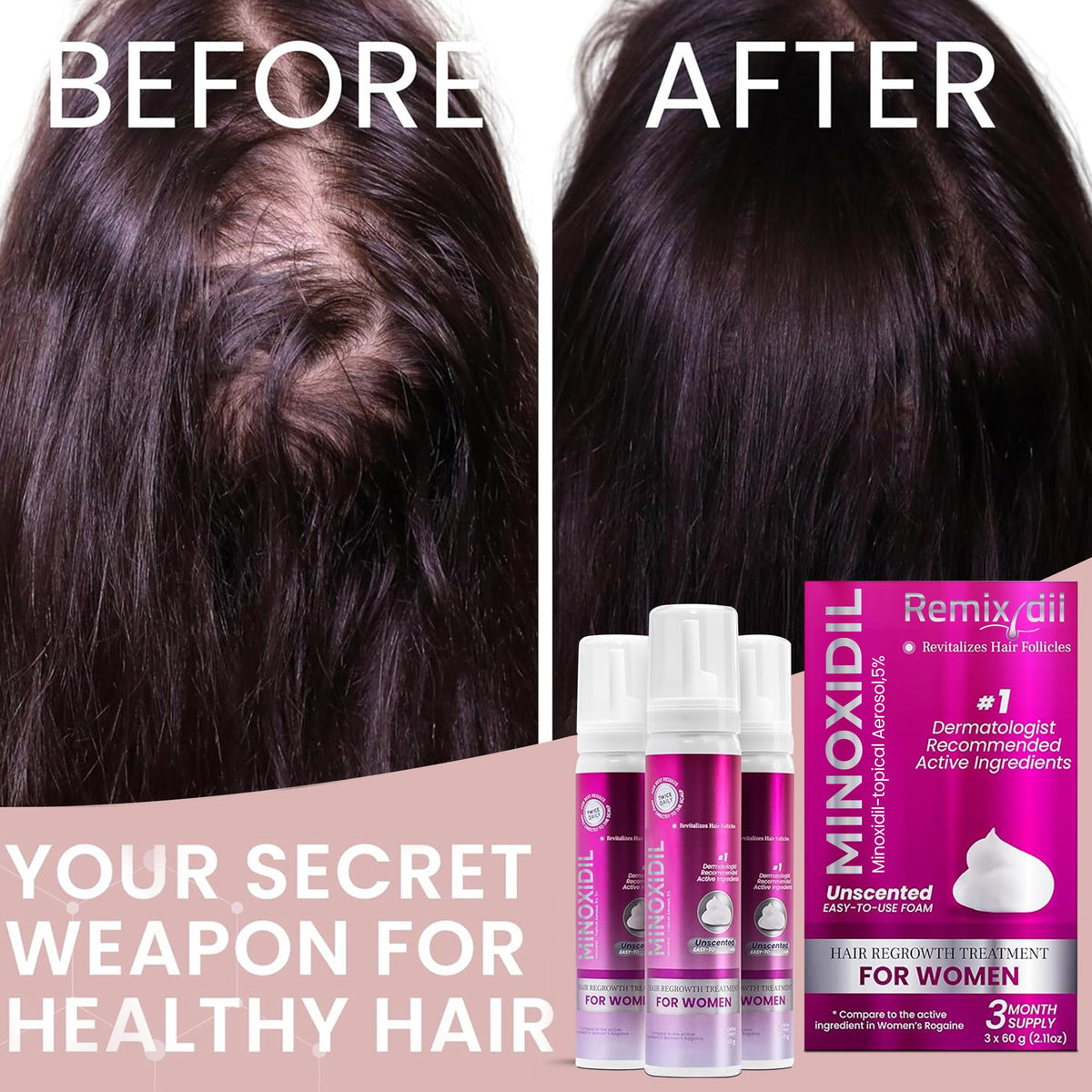 Rida Minoxidil for Women 5% Foam lifestyle scene