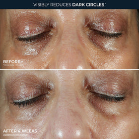 RoC Brightening Eye Cream packaging details