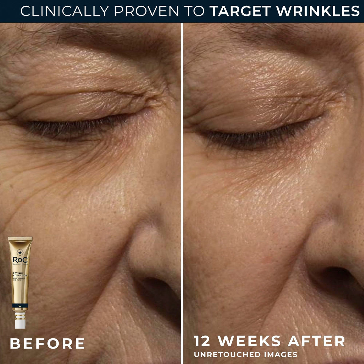 RoC Deep Wrinkle Night Cream application on skin