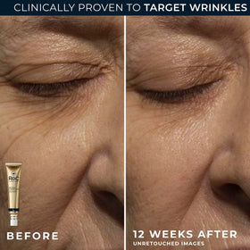 RoC Deep Wrinkle Night Cream application on skin