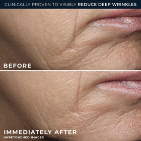RoC Deep Wrinkle Rich Cream application on skin