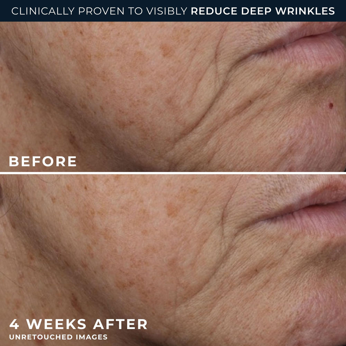RoC Deep Wrinkle Rich Cream with moisturizing ingredients