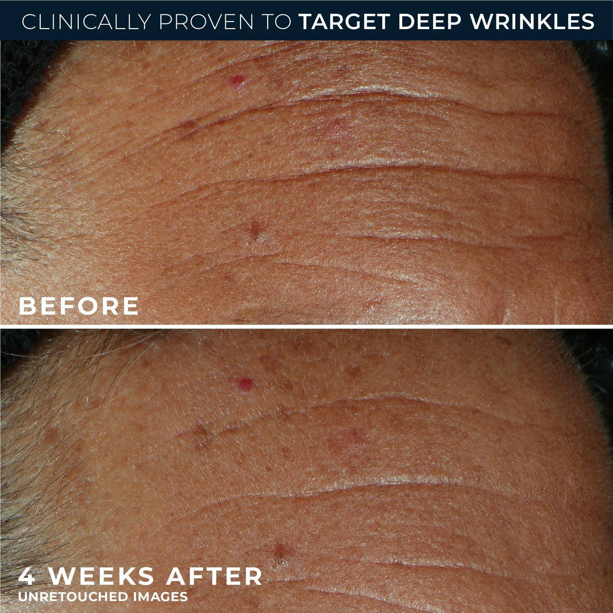 RoC Derm Correxion Fill+ Retinol Serum lifestyle scene