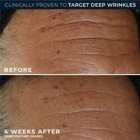 RoC Derm Correxion Fill+ Retinol Serum lifestyle scene
