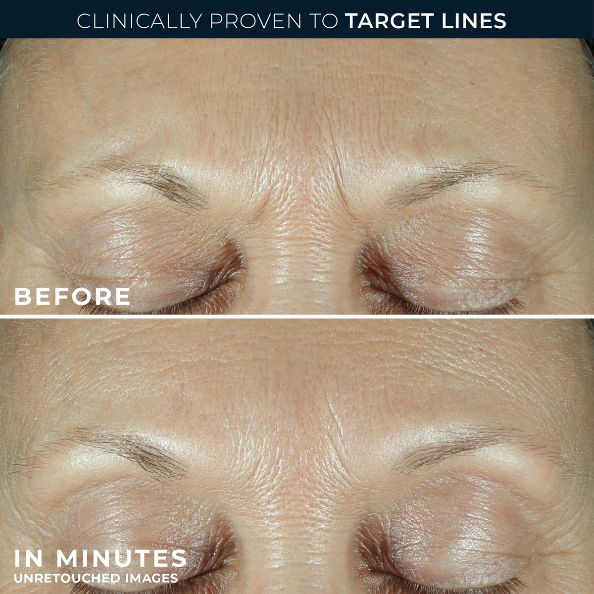 RoC Derm Correxion Fill+ Retinol Serum with hyaluronic acid ingredients