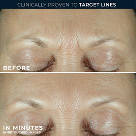 RoC Derm Correxion Fill+ Retinol Serum with hyaluronic acid ingredients