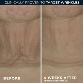 RoC Derm Correxion Retinol Serum Stick side view