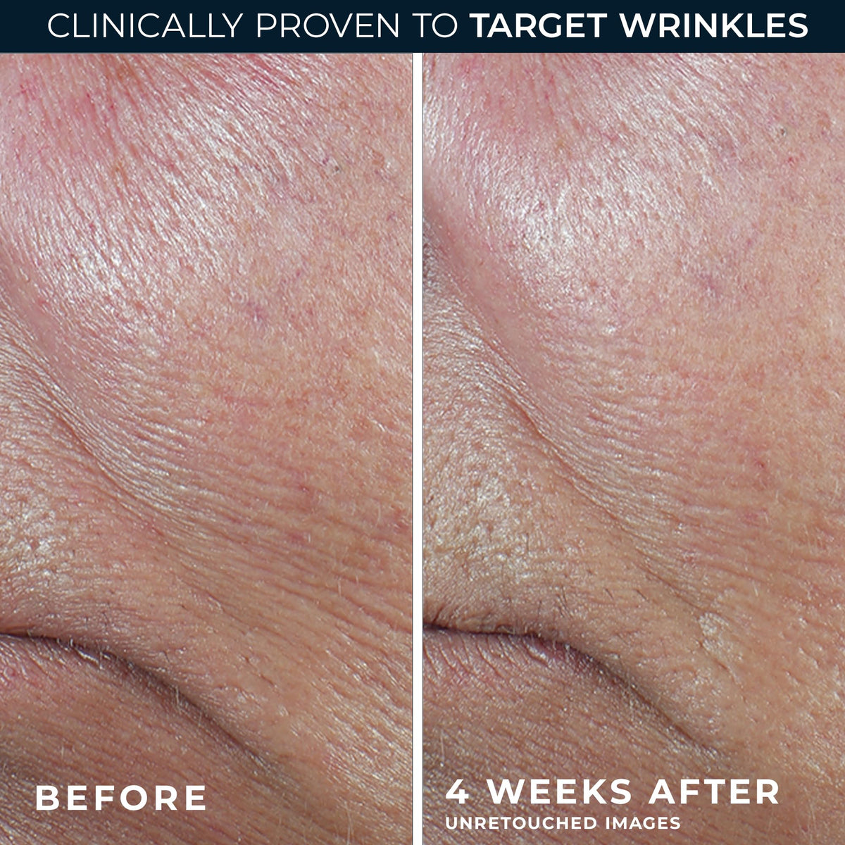 RoC Derm Correxion Retinol Serum Stick texture close-up