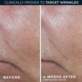 RoC Derm Correxion Retinol Serum Stick texture close-up