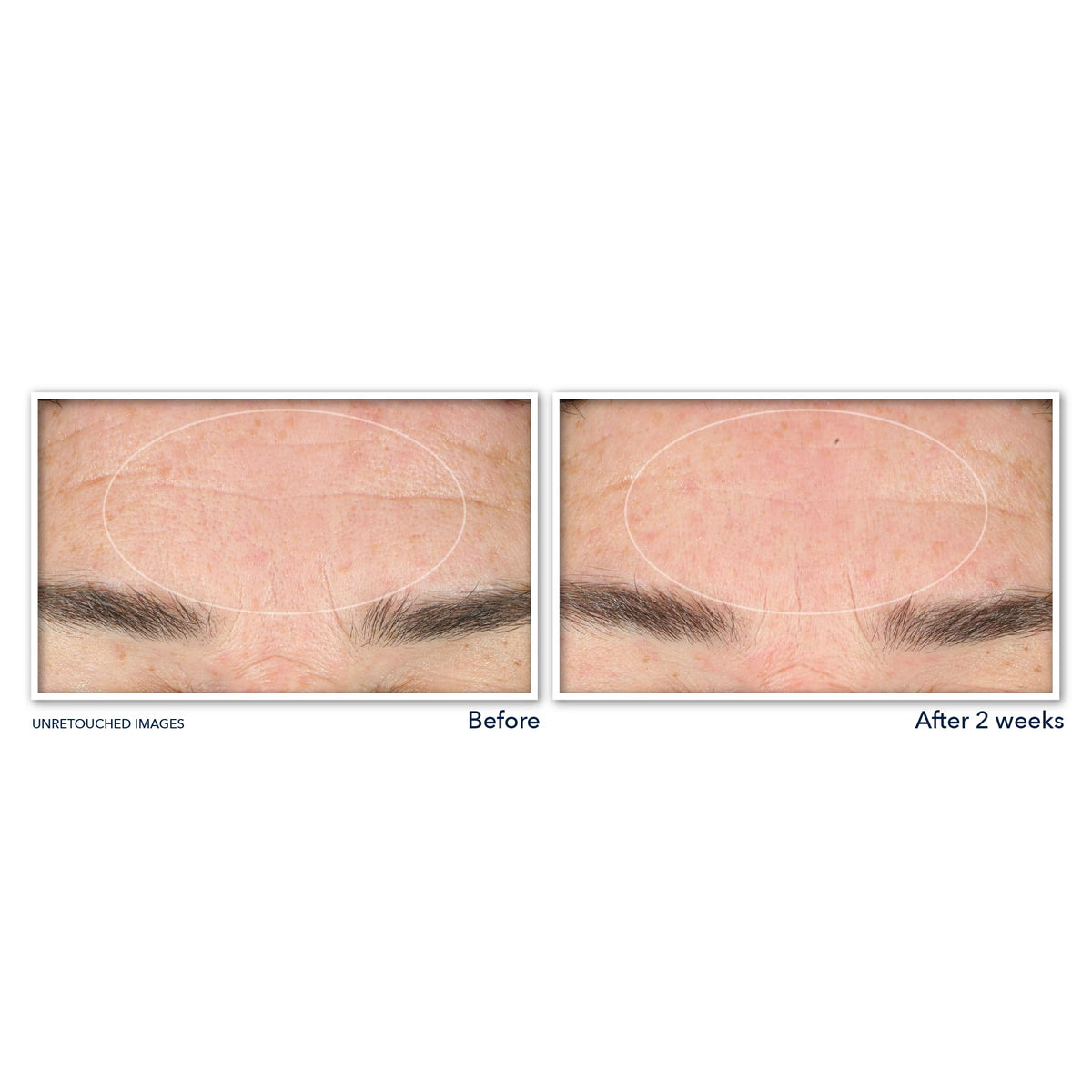 RoC Derm Correxion Serum Cleanser back view with ingredient list