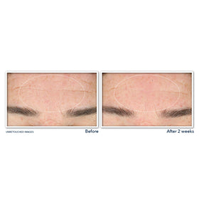 RoC Derm Correxion Serum Cleanser back view with ingredient list