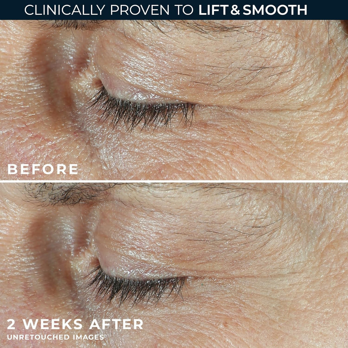 RoC Dual Eye Cream application on eyelids