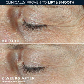 RoC Dual Eye Cream application on eyelids