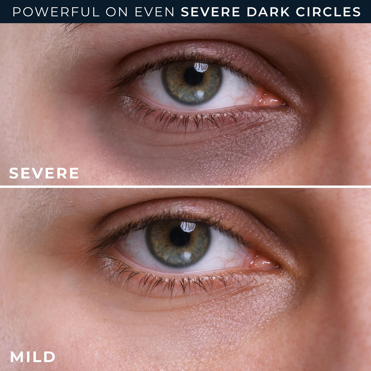 RoC Eye Repair Cream application on skin
