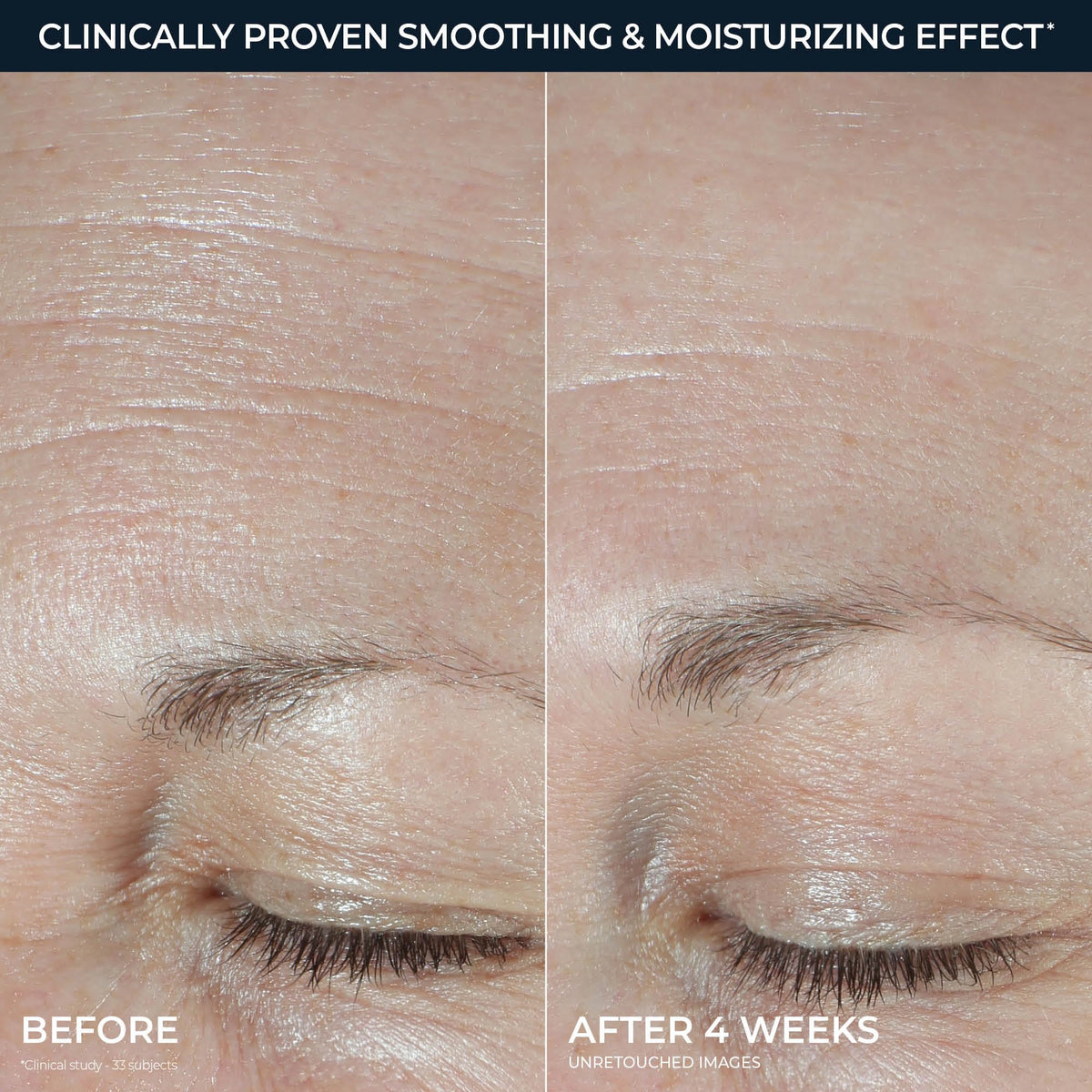 RoC Hydration+ moisturizer applied to skin for hydration