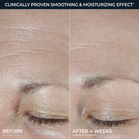 RoC Hydration+ moisturizer applied to skin for hydration