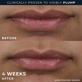 RoC Lip Plumper serum in use on lips