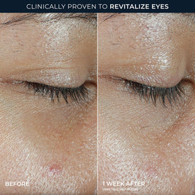 RoC Multi Correxion Eye Balm with ingredients highlighted