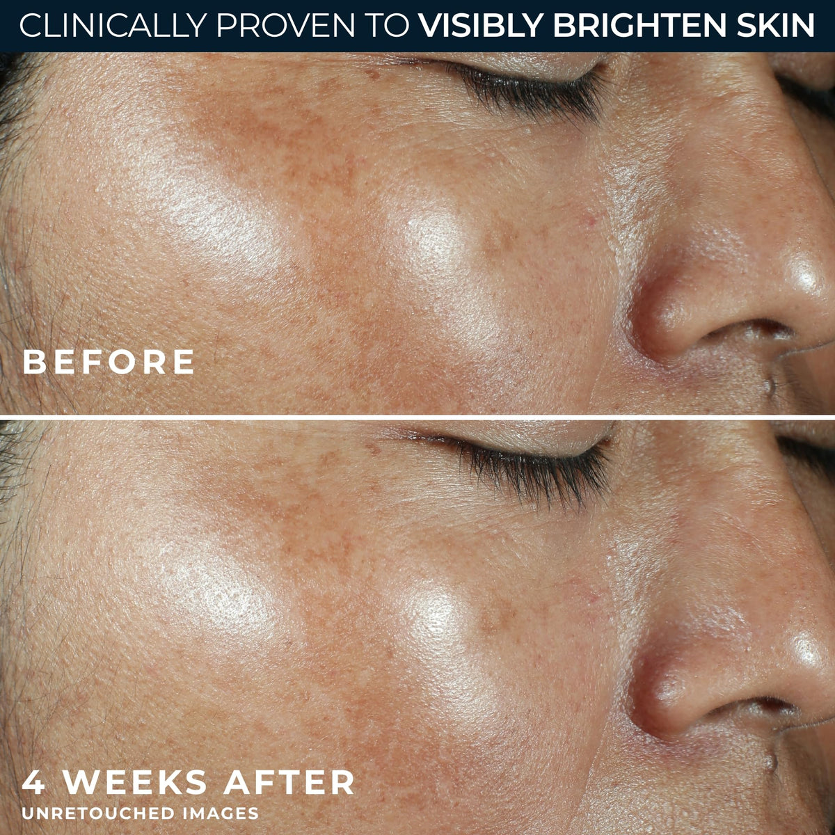 RoC Multi Correxion Vitamin C Sunscreen SPF 30 application on skin