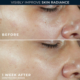 RoC Multi Correxion Vitamin C Sunscreen SPF 30 with other skincare products