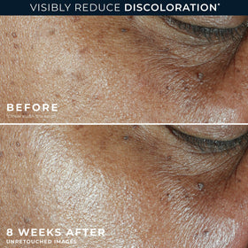 RoC Niacinamide Daily Face Moisturizer SPF 30 lifestyle shot