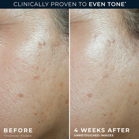 RoC Niacinamide Daily Face Moisturizer SPF 30 with ingredients