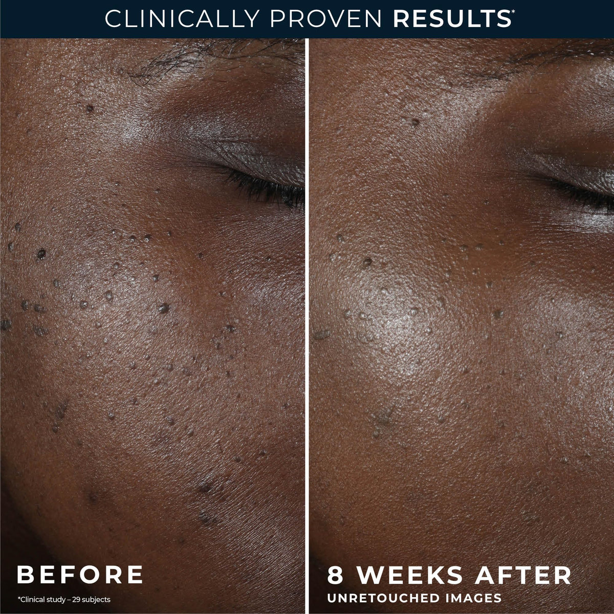RoC Niacinamide Even Tone + Lift Night Cream ingredients list