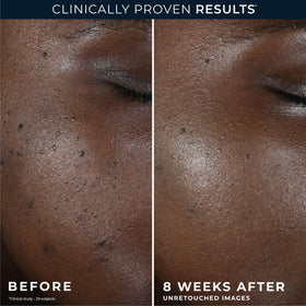 RoC Niacinamide Even Tone + Lift Night Cream ingredients list