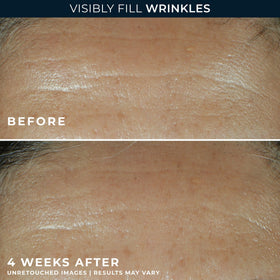 RoC Retinol Correxion Deep Wrinkle Filler on a bathroom counter