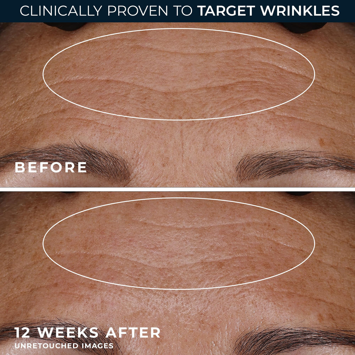 RoC Retinol Correxion Deep Wrinkle Night Cream mineral complex ingredients