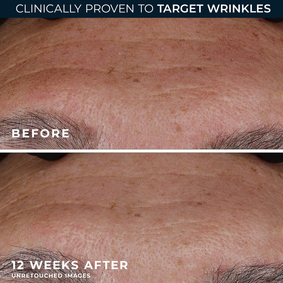 RoC Retinol Correxion Deep Wrinkle Serum application on skin