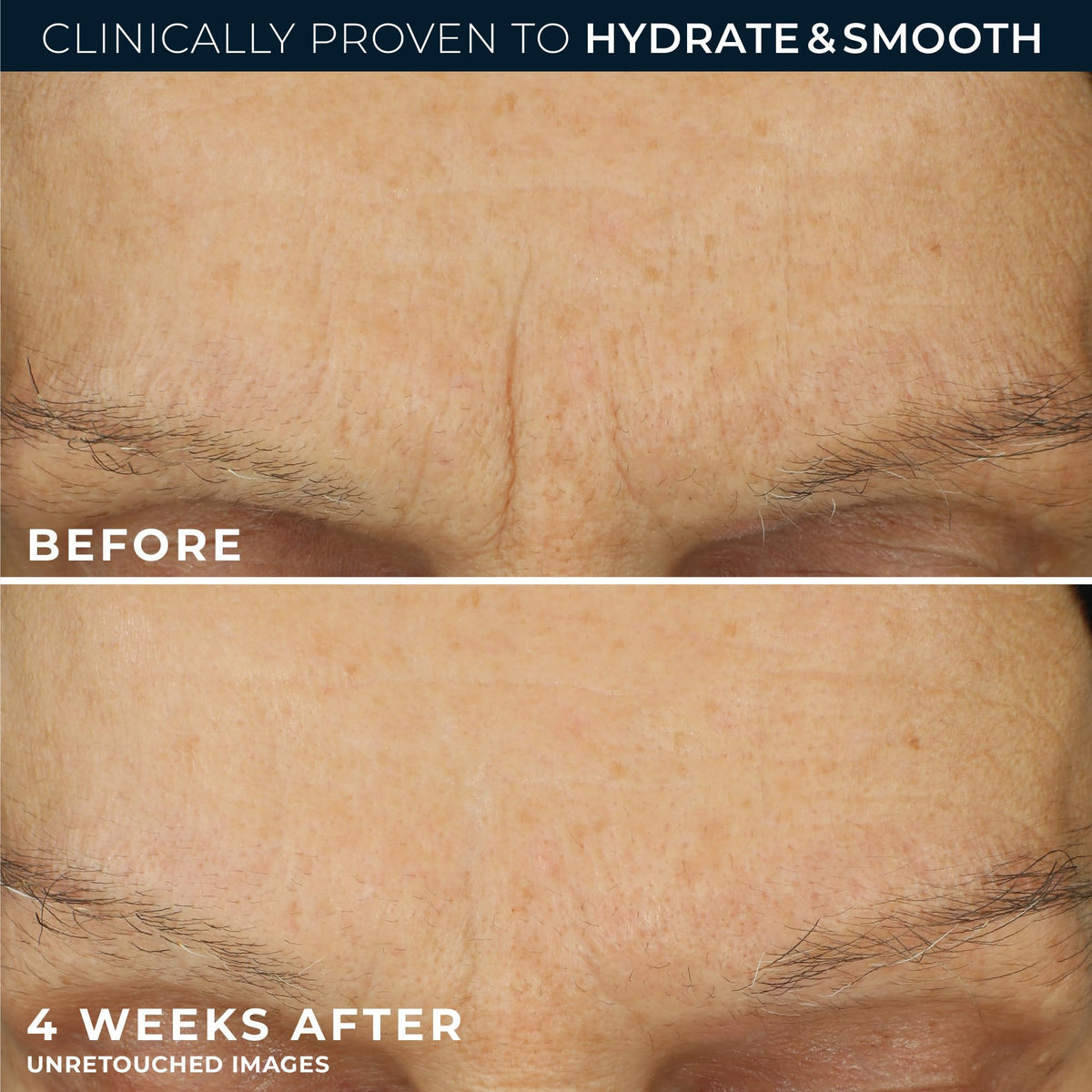 RoC Retinol Correxion Max Hydration Face Moisturizer application on skin